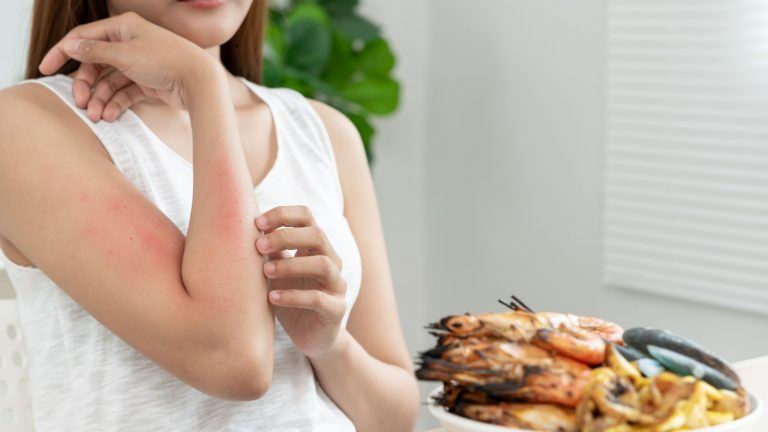 tattoo juckt was tun