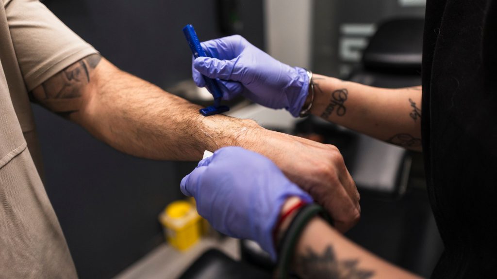 	
was beachten nach tattoo