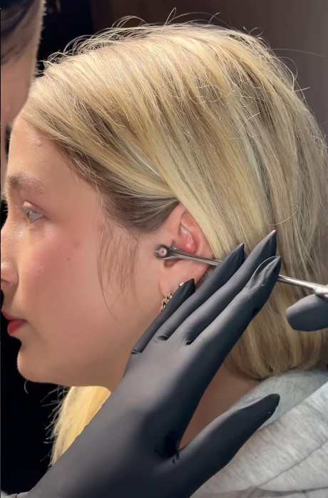 Tragus Piercing Heilung